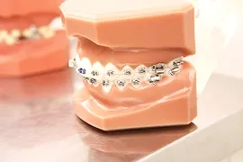 矯正歯科について